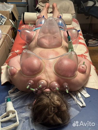 Массаж вакуум банки гуаша правка