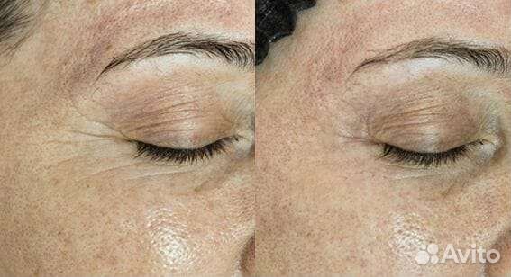 Услуги косметолога