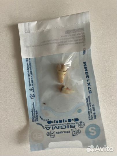 Зуб мудрости