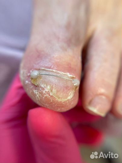 Услуги подолога