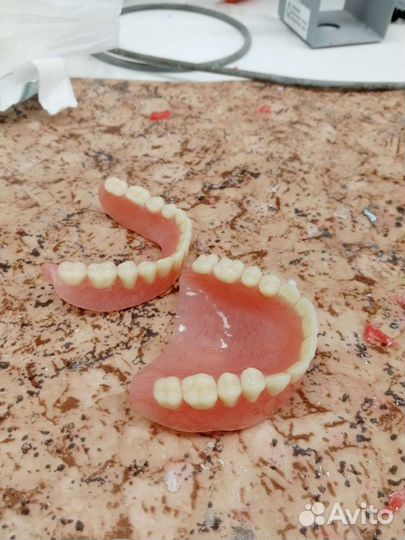 Съёмные Протезы, зубные протезы