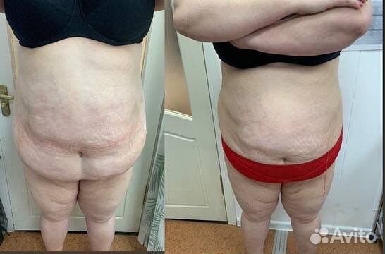 Модели на сушку тела