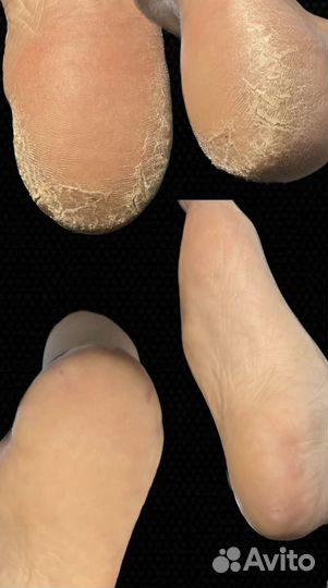 Крем от трещин eurofoot Cream Plus