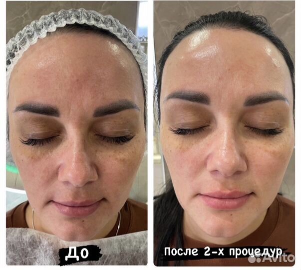 Услуги косметолога