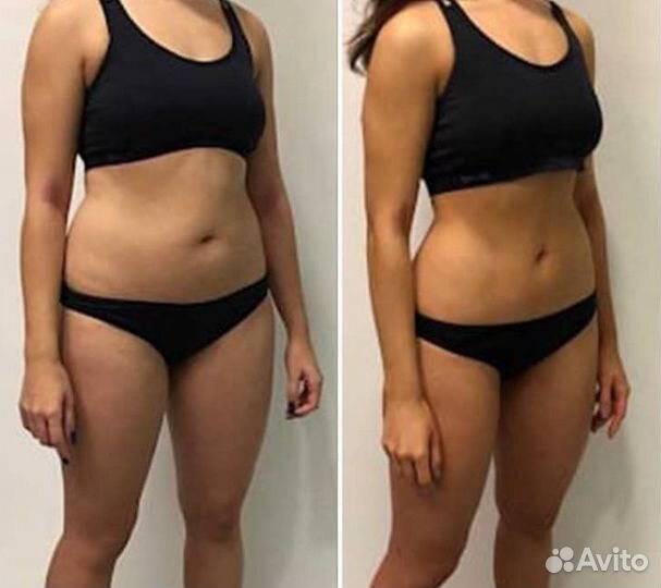 Аппаратный массаж