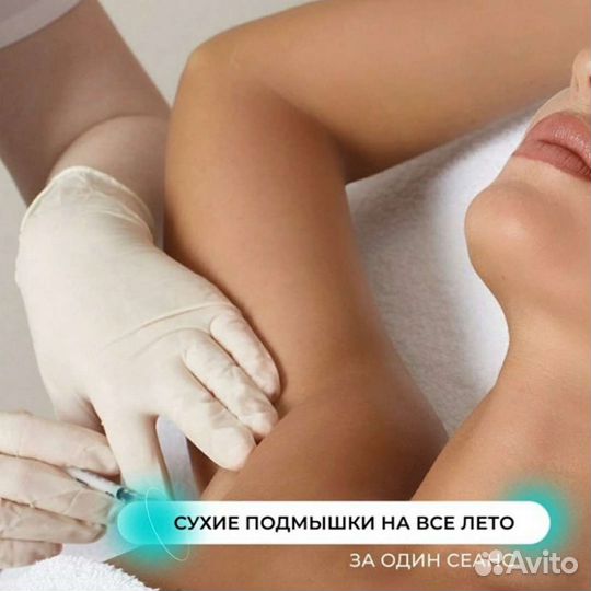 Устранение потливости. Гипергидроз