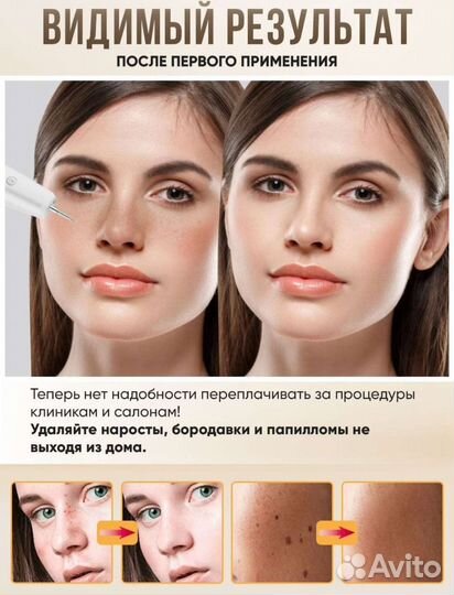 Лазерная ручка для удаления родинок, бородавок