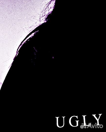 Conjunctiva ugly normal size