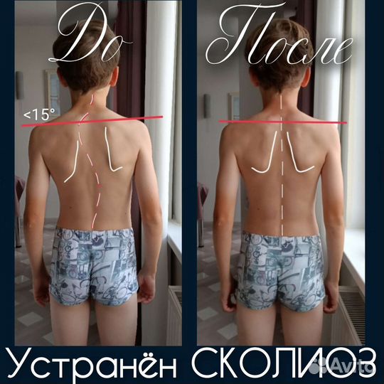 Восстанавливающий массаж