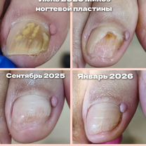 Подология, Зеленоград