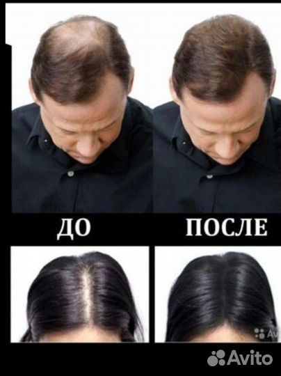 Тоник для загущения волос