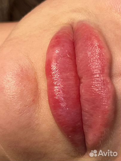 Косметолог иньекцыонист