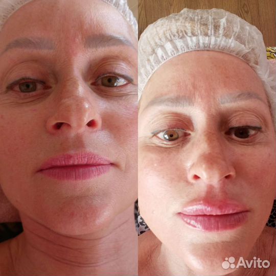 Косметология в Кабардинке