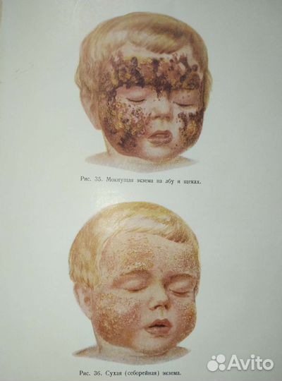 Учебник детских болезней.Медгиз 1958г.ссср