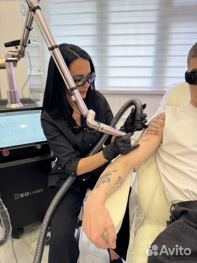 Лазерное удаление тату, ПМ, карбоновый пилинг