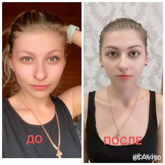 Консультация косметолога