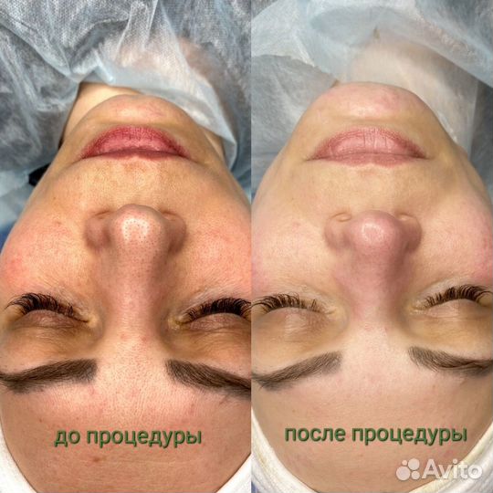 Косметик эстетист