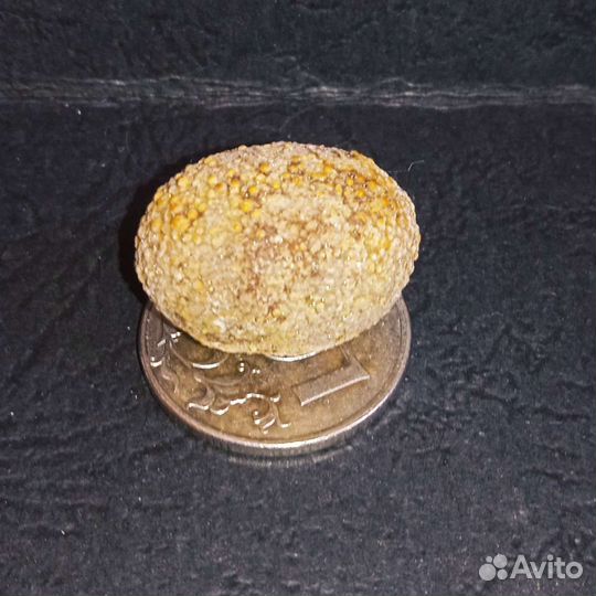 Камень желчного пузыря