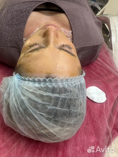 Увеличение губ