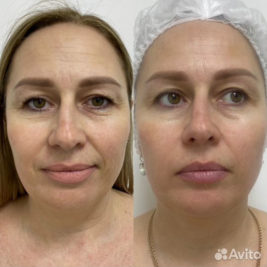 Косметолог Красноармейский