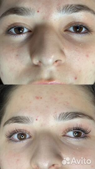 Брови Ресницы