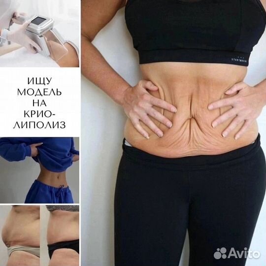 Ищу модель на Криолиполиз