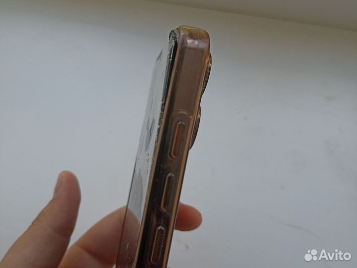 INOI A170, 4/64 ГБ