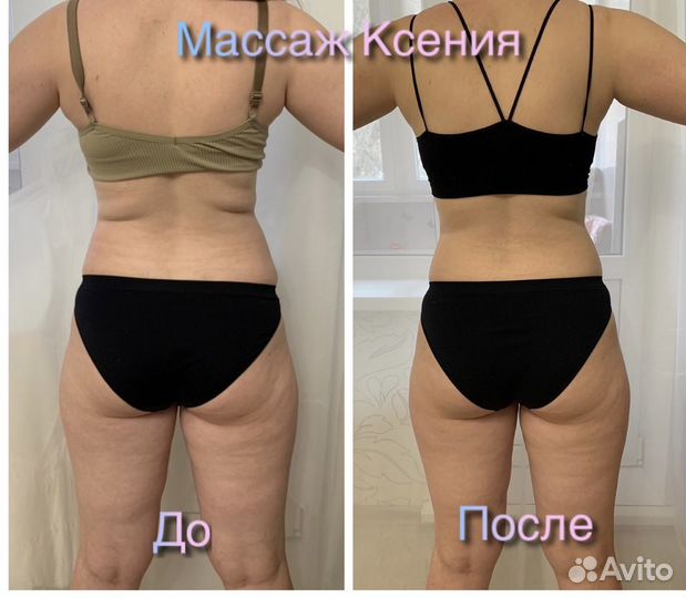 Аппаратная коррекция фигуры