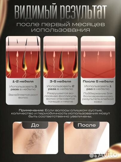 Фотоэпилятор