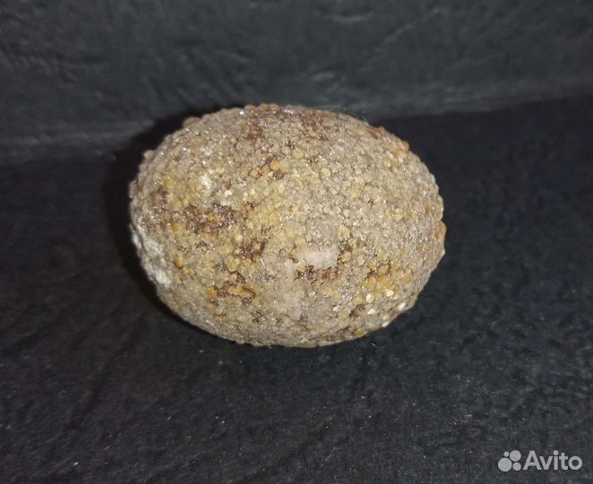 Камень желчного пузыря