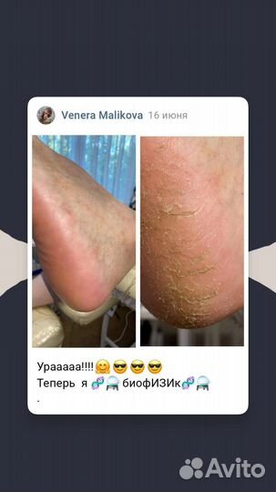 Смарт педикюр