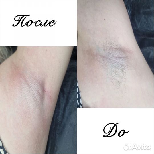 Маникюр /педикюр и депиляция