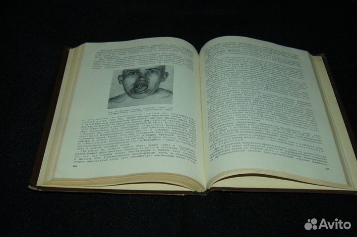 Введение клиническую невропатологию