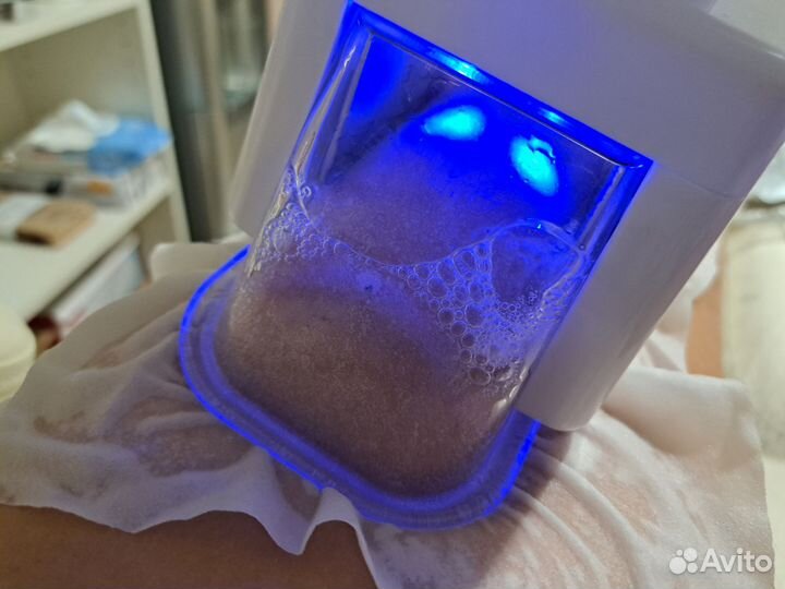 Криолиполиз