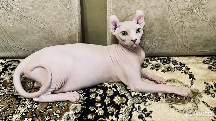 Девочка носитель гетерохромии