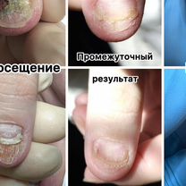 Подолог, Нижний Новгород