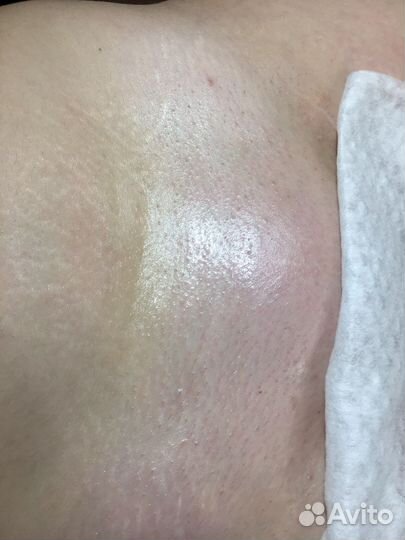 Шугаринг/Гелинг