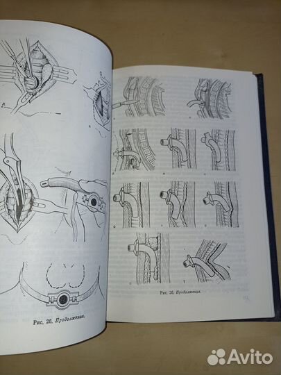Руководство поо детской оториноларингологии. 1985