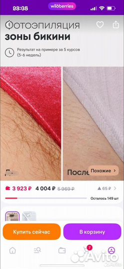 Фотоэпилятор