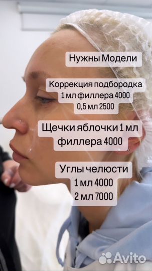 Увеличение губ, ботокс,мезотерапия