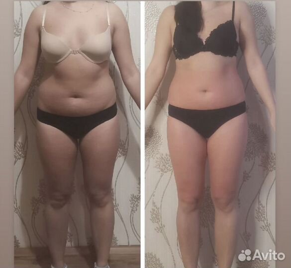 Антицеллюлитный массаж ручной Мадера Пролетарская