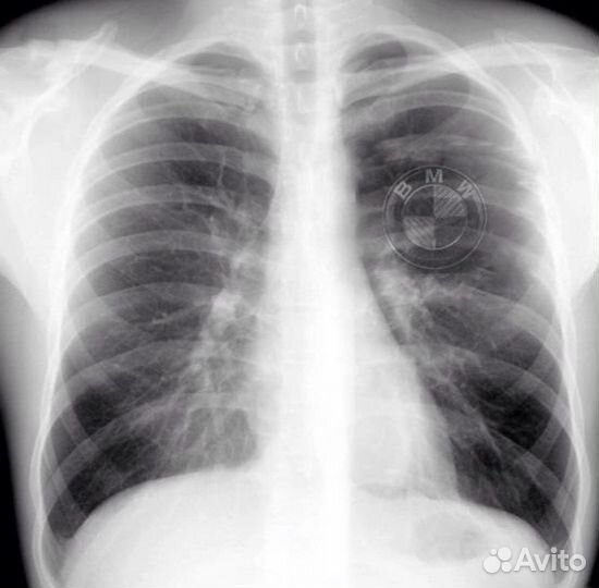 Подбор автомобиля BMW