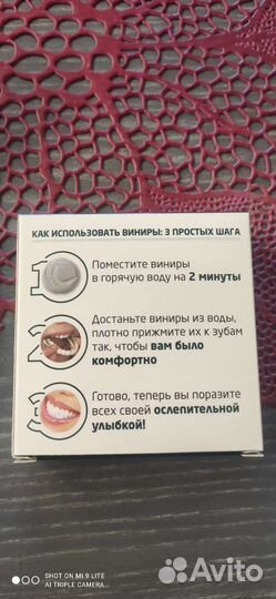 Виниры на зубы