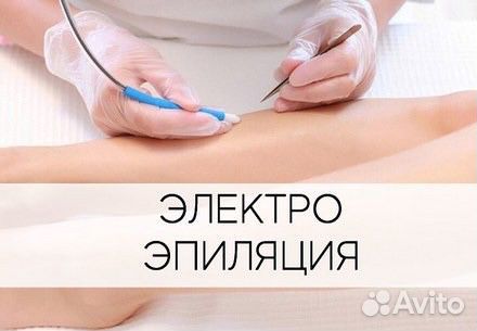 Электроэпиляция