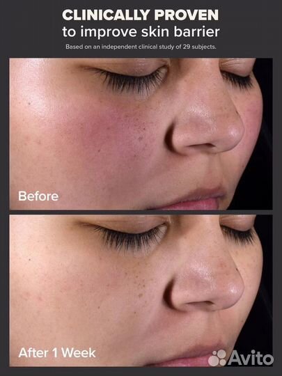 Paula's choice Salicylic Acid. 30 ml