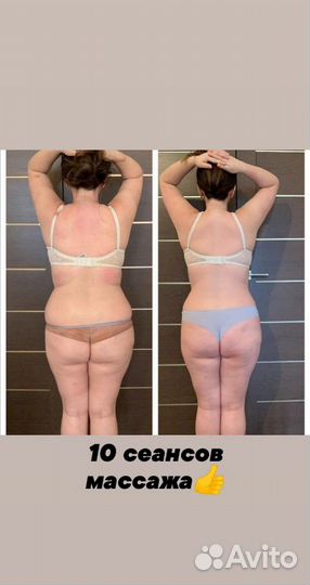 Антицеллюлитный массаж(с выездом на дом)