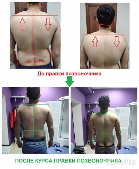 Мануальный терапевт костоправ