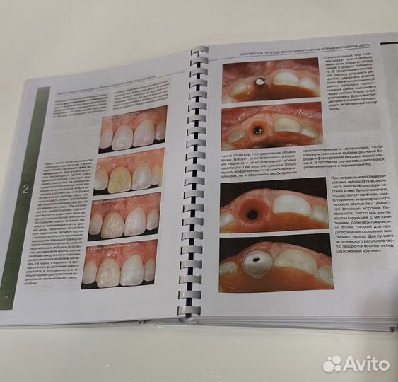 Пластическая хирургия мягких тканей Зукелли 2023