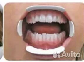 4) Оптрагейт, ретрактор для губ, роторасширитель