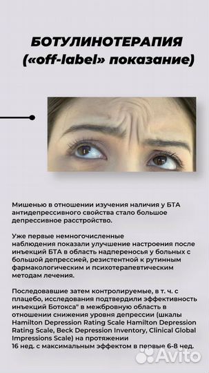 Ботокс для лица